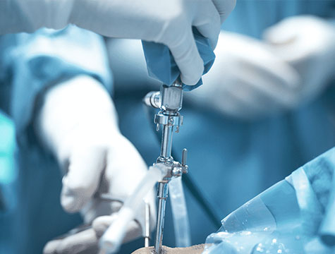 Sportska medicina - set za artroskopiju